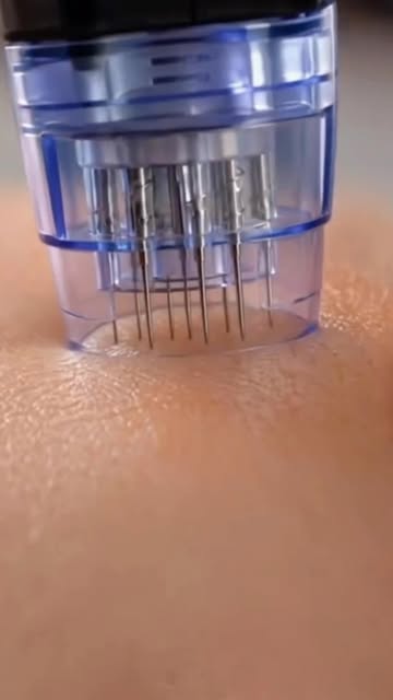 Detalhe macro de um cartucho de microagulhamento encostado na pele.